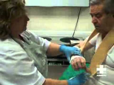 Vídeo cuidador. Cuidados en paciente escayolado